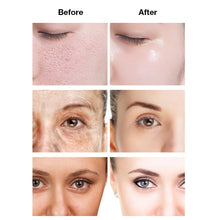 Load image into Gallery viewer, 24K Gold Hyaluronic Acid Face Serum Replenishment Moisturize Shrink Pore Brighten Nicotinamide Skin Care Lift Firming Essence