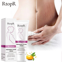 Load image into Gallery viewer, RtopR by Traci K Beauty Mango Remove Pregnancy Scars Acne Cream Stretch Marks Treatment Maternity Repair Anti-Aging Anti-Winkles Firming Body Creams
