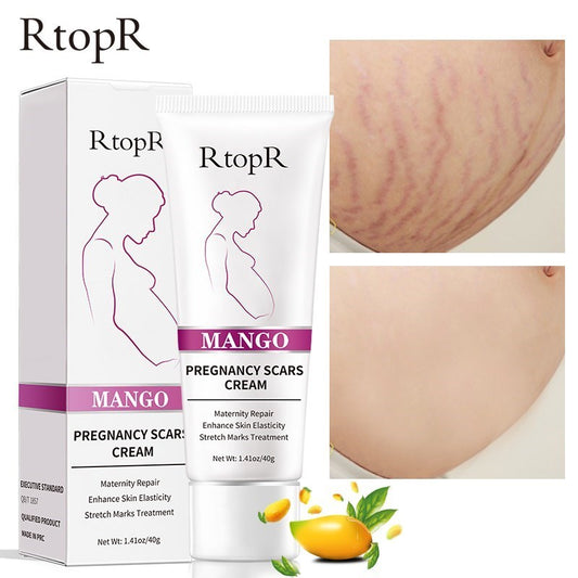 RtopR by Traci K Beauty Mango Remove Pregnancy Scars Acne Cream Stretch Marks Treatment Maternity Repair Anti-Aging Anti-Winkles Firming Body Creams
