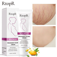 Load image into Gallery viewer, RtopR by Traci K Beauty Mango Remove Pregnancy Scars Acne Cream Stretch Marks Treatment Maternity Repair Anti-Aging Anti-Winkles Firming Body Creams