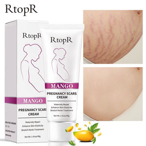 RtopR by Traci K Beauty Mango Remove Pregnancy Scars Acne Cream Stretch Marks Treatment Maternity Repair Anti-Aging Anti-Winkles Firming Body Creams