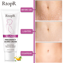 Load image into Gallery viewer, RtopR by Traci K Beauty Mango Remove Pregnancy Scars Acne Cream Stretch Marks Treatment Maternity Repair Anti-Aging Anti-Winkles Firming Body Creams