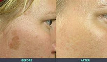 Load image into Gallery viewer, Restore Cream for Age Prone Areas and Fine Lines