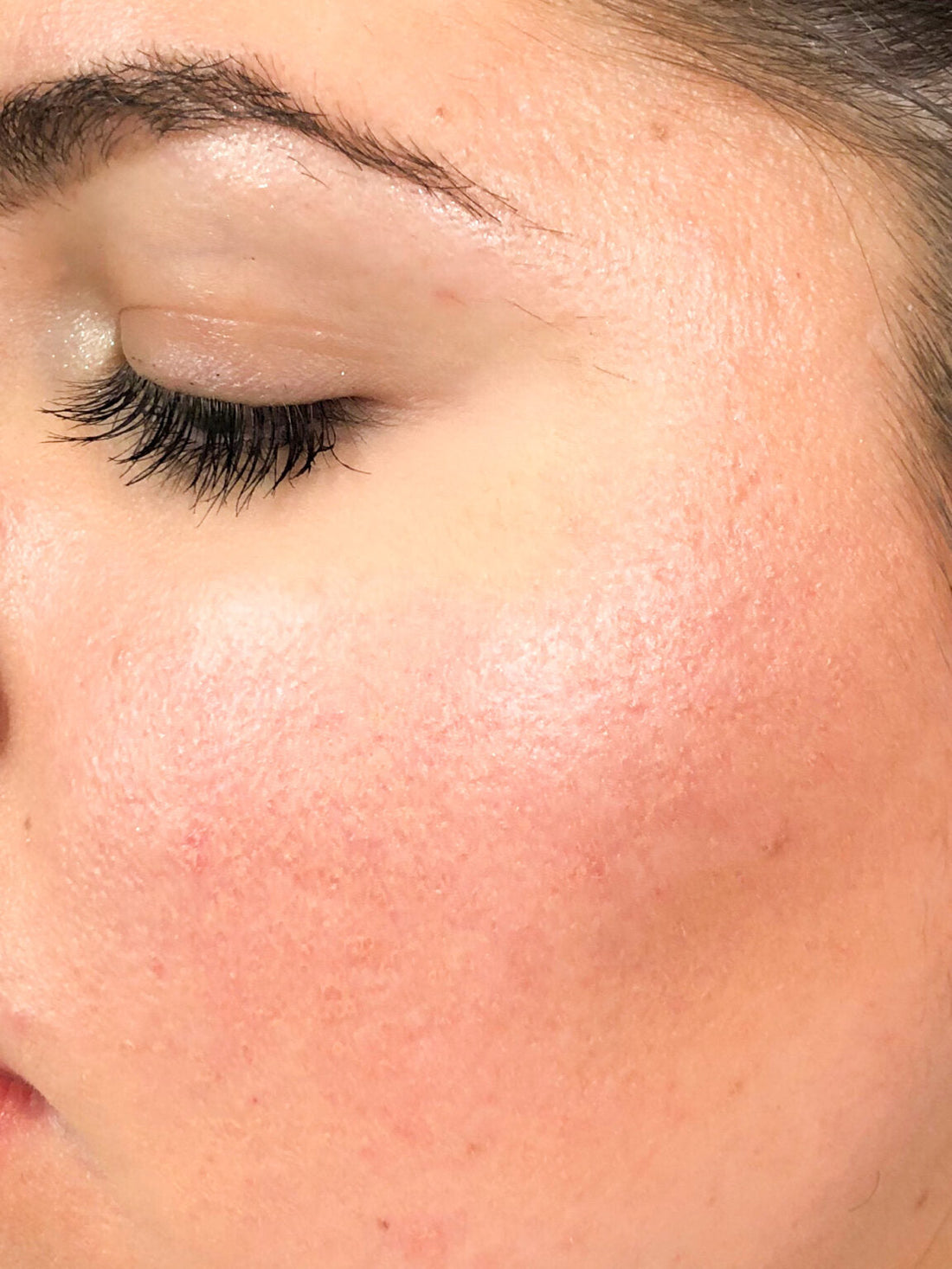 A Crucial Step in Your Summer Daily Skin Care Routine