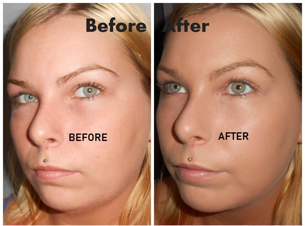 Skin Care Sale! Under $100 Picks