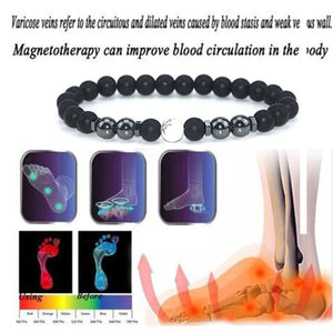Magnetic Therapy Varicose Veins Spider Veins  accessories new classical fashion magnet chain seven colored stone sand gravel