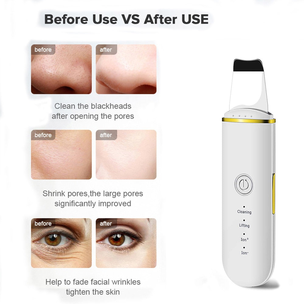 Traci K Beauty Ultrasonic Skin Scrubber USB Plug Facial Blackhead Remover Face Massager Skincare Tools Products Face Cleansing Acne