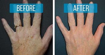 Restore Cream for Age Prone Areas and Fine Lines