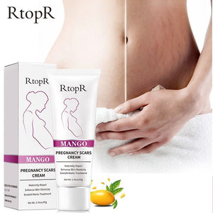 RtopR by Traci K Beauty Mango Remove Pregnancy Scars Acne Cream Stretch Marks Treatment Maternity Repair Anti-Aging Anti-Winkles Firming Body Creams