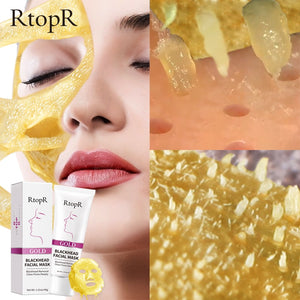 RtopR by Traci K Beauty- New Gold Remove Blackhead Gel Facial Pore Peeling Acne Treatment Nose Deep Cleansing Face Whitening Hydrating  Golden mud