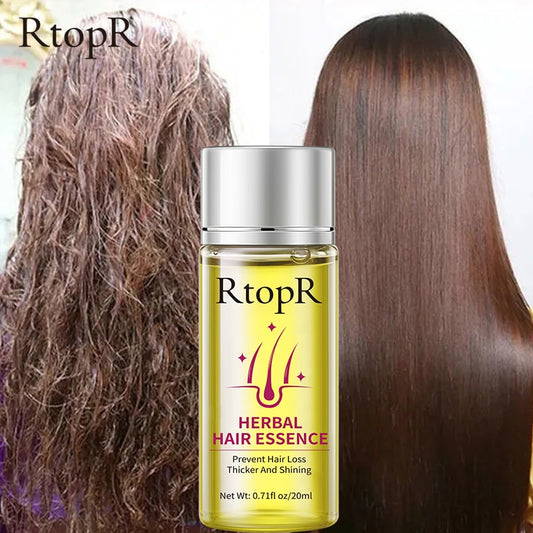 RtopR by Traci K Beauty Hair Growth Anti Hair Loss Liquid Promote Thick Fast Hair Growth Treatment 20ml Essential Oil Health Care Beauty Essence