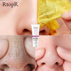 RtopR by Traci K Beauty- New Gold Remove Blackhead Gel Facial Pore Peeling Acne Treatment Nose Deep Cleansing Face Whitening Hydrating  Golden mud