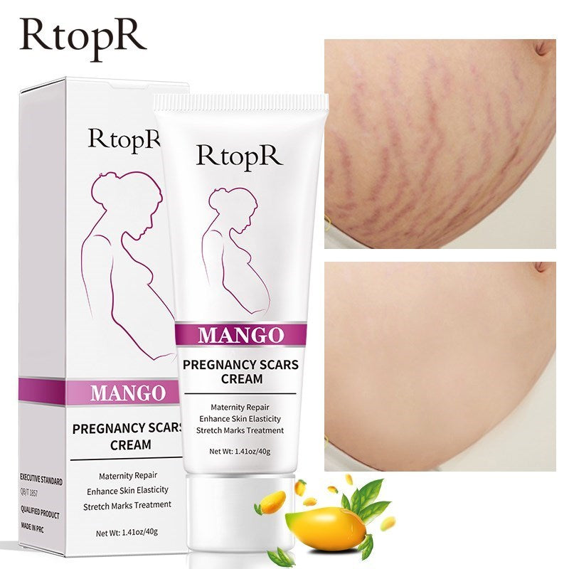 RtopR by Traci K Beauty Mango Remove Pregnancy Scars Acne Cream Stretch Marks Treatment Maternity Repair Anti-Aging Anti-Winkles Firming Body Creams