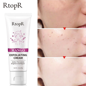 RtopR by Traci K Beauty Face Exfoliating Cream Skin Care Whitening Moisturizer Repair Facial Scrub Cleaner Acne Blackhead Treatment Remove Face Cream