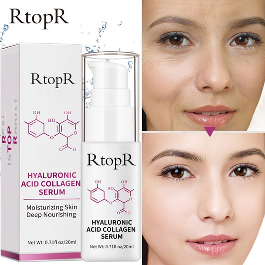 RtopR by Traci K Beauty Hyaluronic Acid Collagen Face Serum Whitening Anti-Aging Facial Serum Acne Treatment Anti Wrinkle Skin Care Essence Face Care