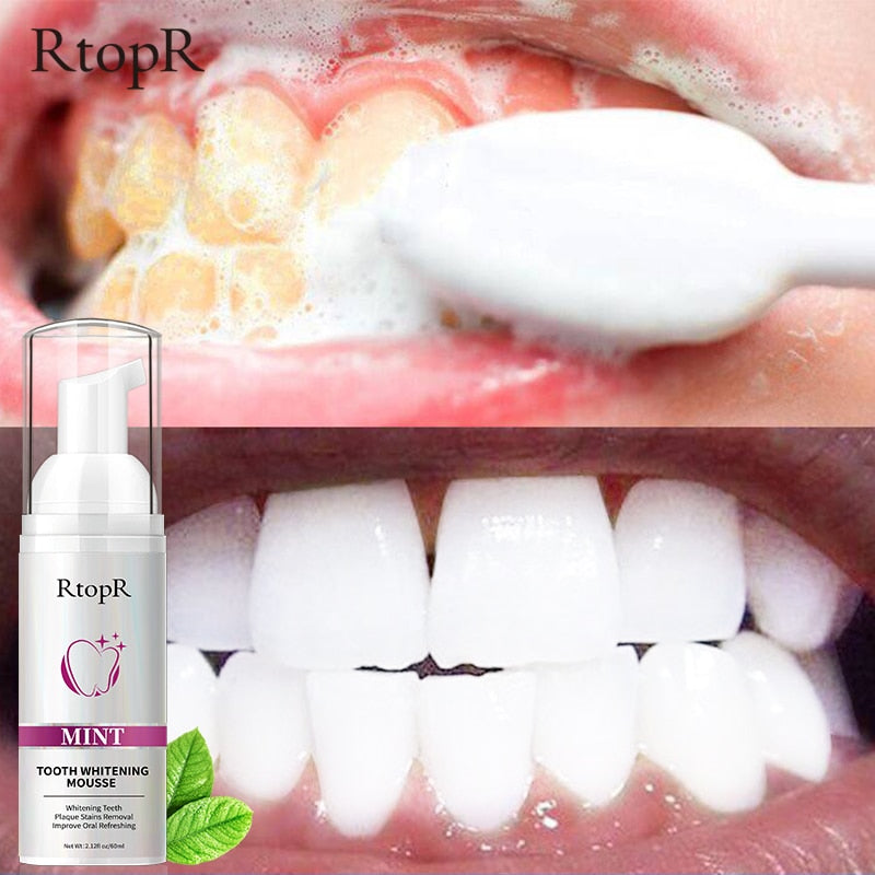RtopR by Traci K Beauty Teeth Cleansing Whitening Mousse Removes Stains Teeth Whitening Oral Hygiene Mousse Toothpaste Whitening and Staining 60ml