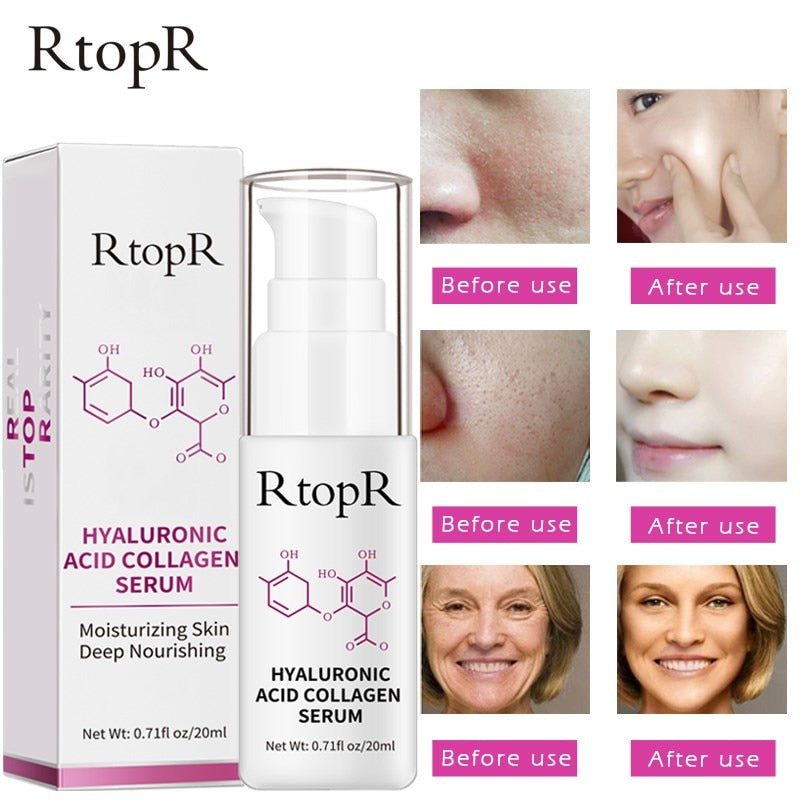 RtopR by Traci K Beauty Hyaluronic Acid Collagen Face Serum Whitening Anti-Aging Facial Serum Acne Treatment Anti Wrinkle Skin Care Essence Face Care
