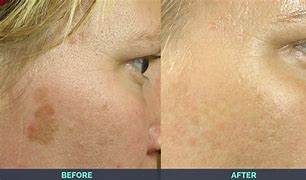 Restore Cream for Age Prone Areas and Fine Lines